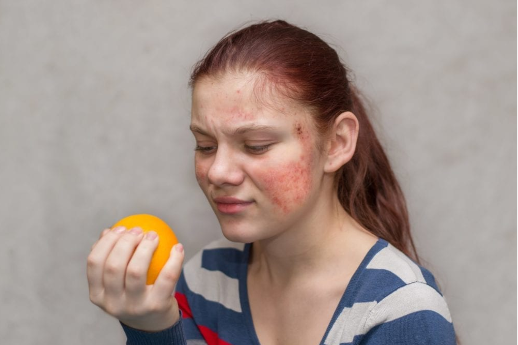 food-intolerance-vs-allergies